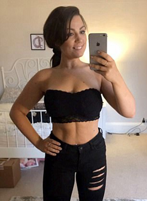 Woman with uneven breasts lost weight to have corrective surgery