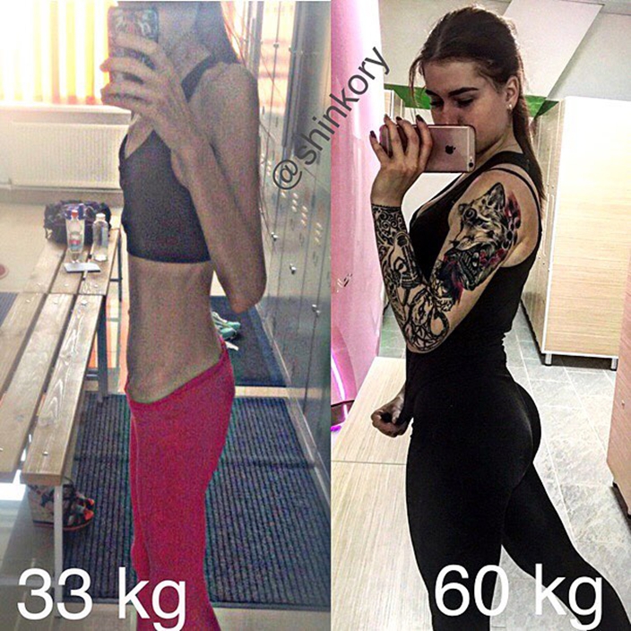 Anorexia Russian Girls Transformation Funfeed