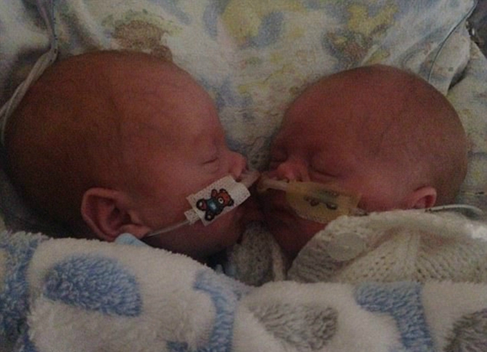 Weak premature twins reversed miraculously after embracing | FunFeed